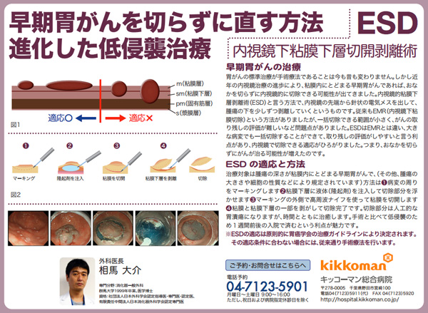 早期胃がんを切らずに直す方法進化した底侵襲治療・ESD内視鏡下粘膜下層切開剥離術